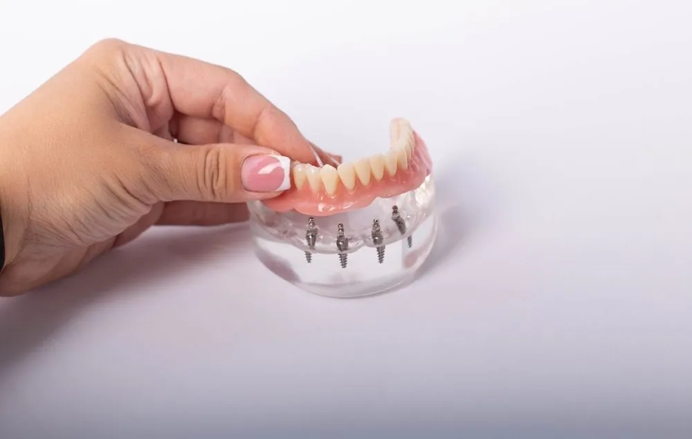 An All-on-4 full-arch implant restoration held in hand