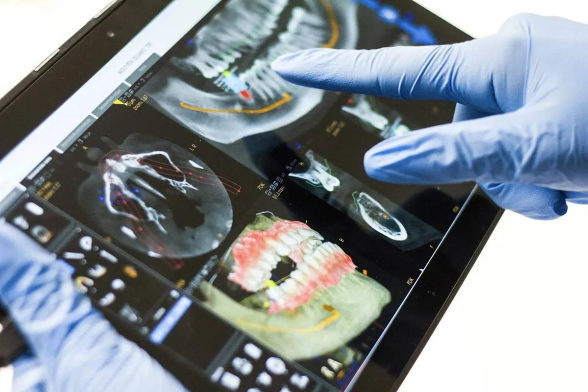 A dentist reviewing a 3D dental scan for implant planning at Dentist In The Park