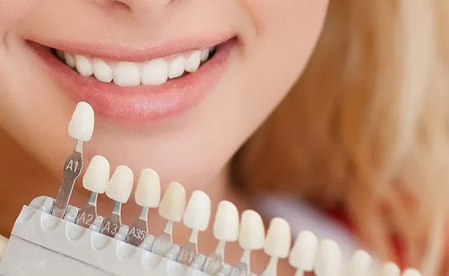 Matching a tooth shade guide before whitening