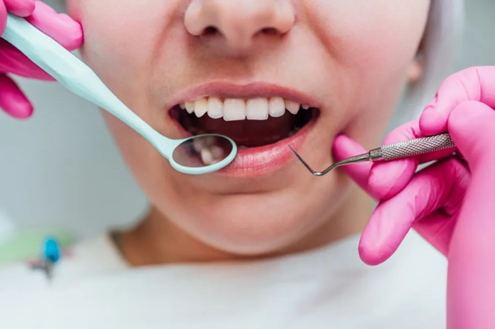 Cosmetic Dentistry in Bondi Junction — Your Main Options Explained