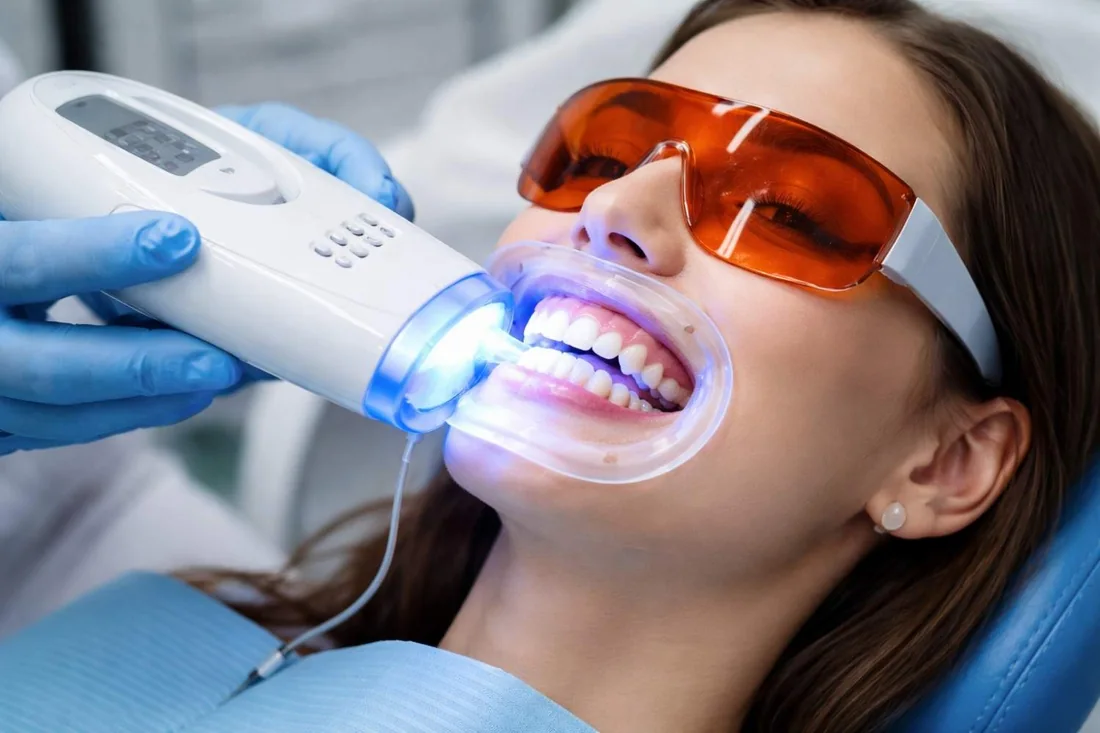 In-chair professional teeth whitening at Dentist In The Park, Bondi Junction