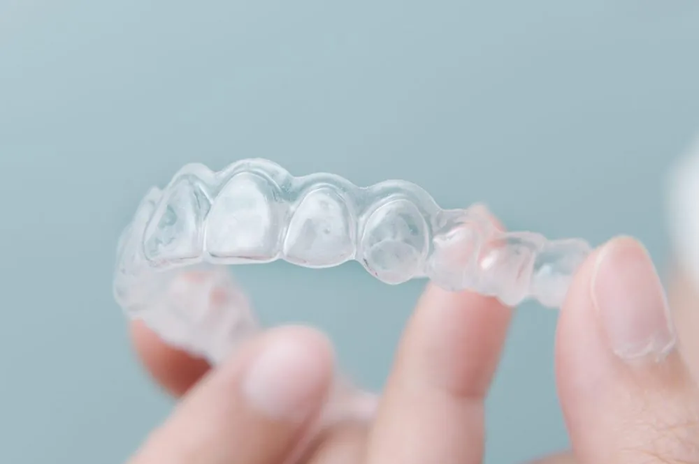 Invisalign Bondi Junction — How It Works, Timelines and Who It Suits