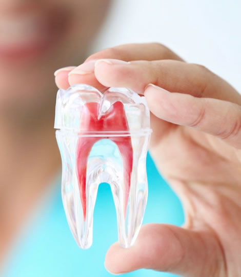 A model of a tooth showing the inner pulp and roots — root canal treatment at Dentist In The Park, Bondi Junction