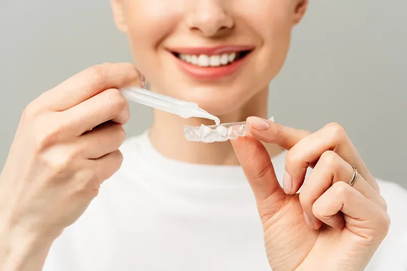 Custom take-home teeth whitening trays