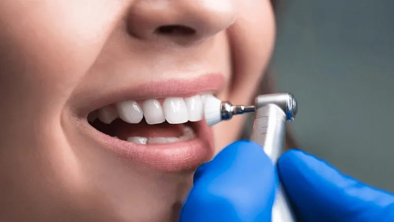 A professional teeth clean and polish at Dentist In The Park, Bondi Junction